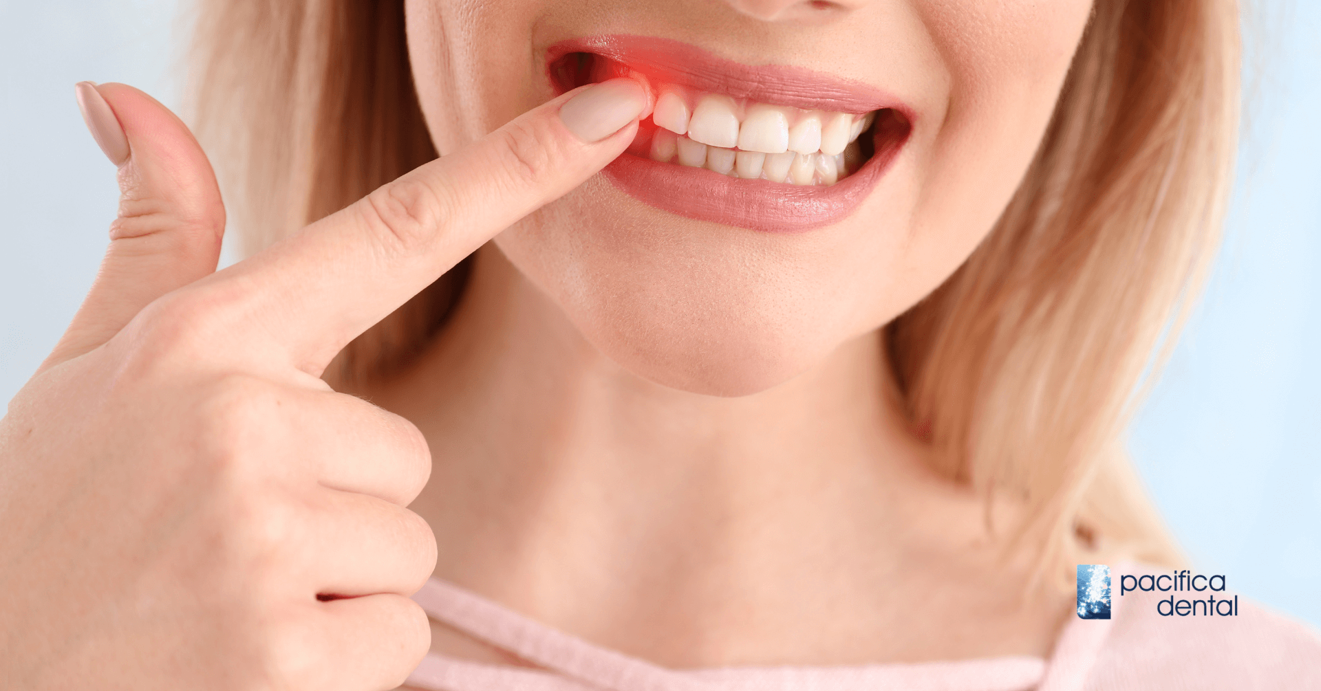 The Connection Between Acidic Diets and Tooth Erosion