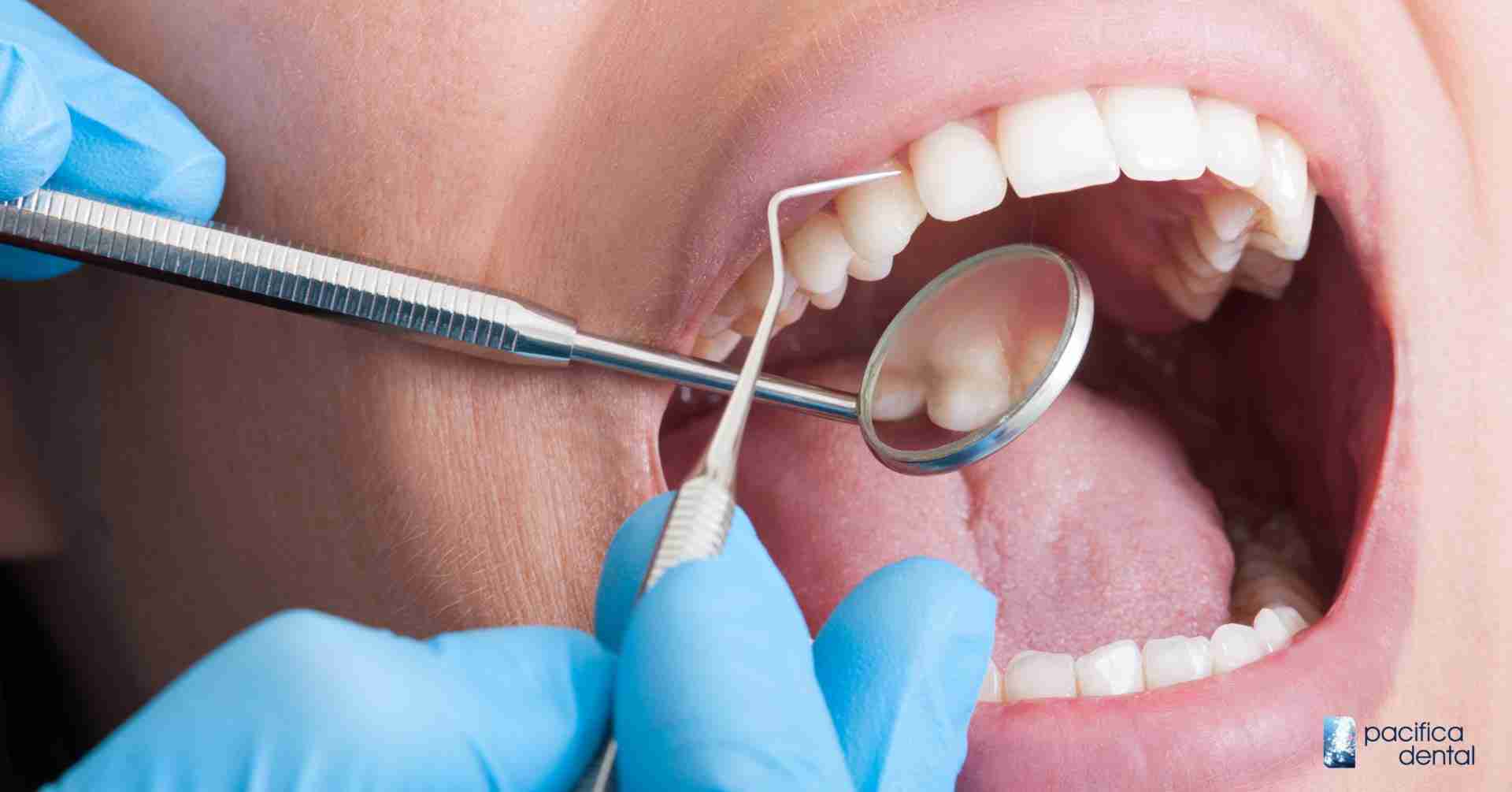 Dental Exam & Hygiene